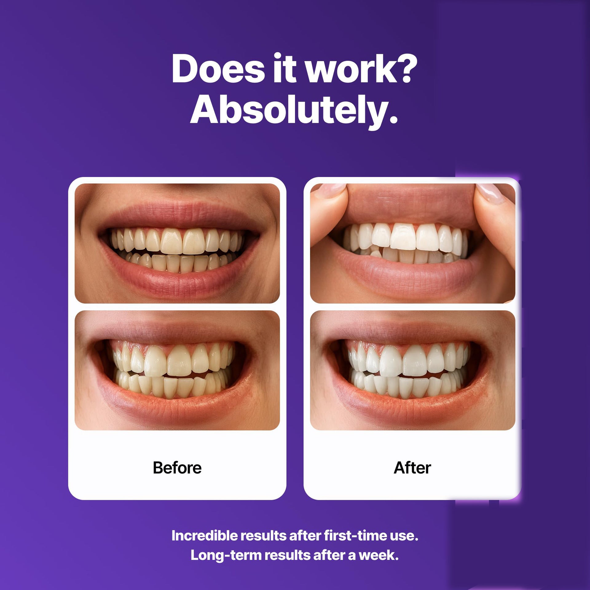Enamel layer teeth Whitening Strips